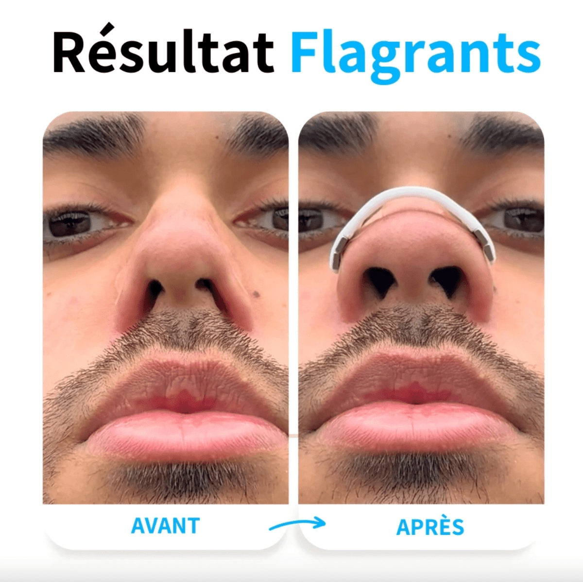 15x Strisce Nasali Magnetiche - Migliorano il Flusso d'Aria