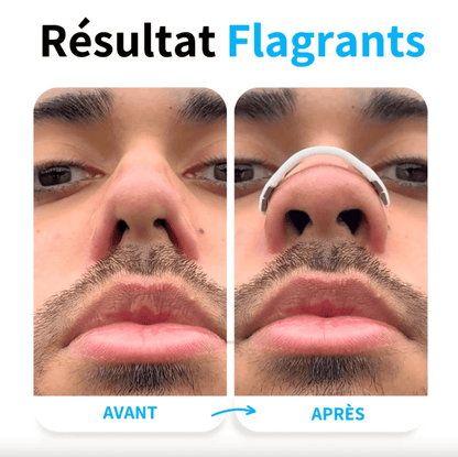 15x Strisce Nasali Magnetiche - Migliorano il Flusso d'Aria