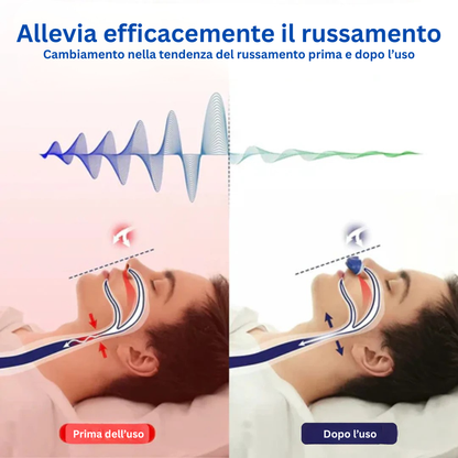 Micro CPAP Portatile Anti-Russamento Apnea del Sonno