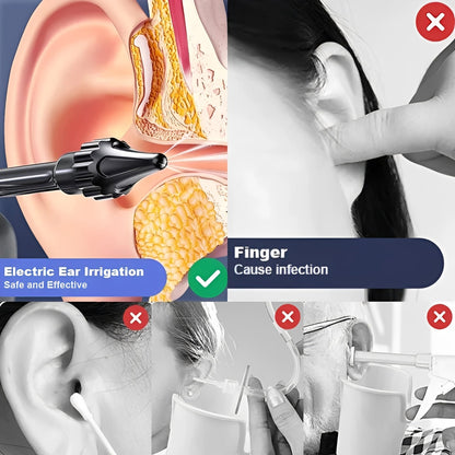 Dispositivo per Irrigazione Auricolare a Base d’Acqua con Batteria Ricaricabile USB