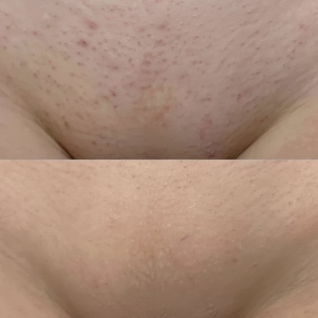 Rasoio elettrico per donne, impermeabile, per pelle sensibile e per la linea bikini