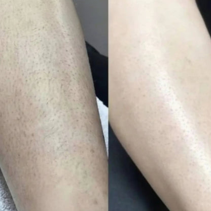 Rasoio elettrico per donne, impermeabile, per pelle sensibile e per la linea bikini