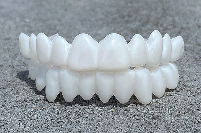 Faccette dentali estetiche professionali per un sorriso sicuro e splendido