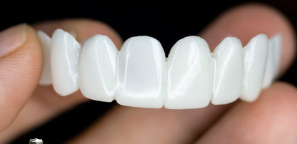 Faccette dentali estetiche professionali per un sorriso sicuro e splendido