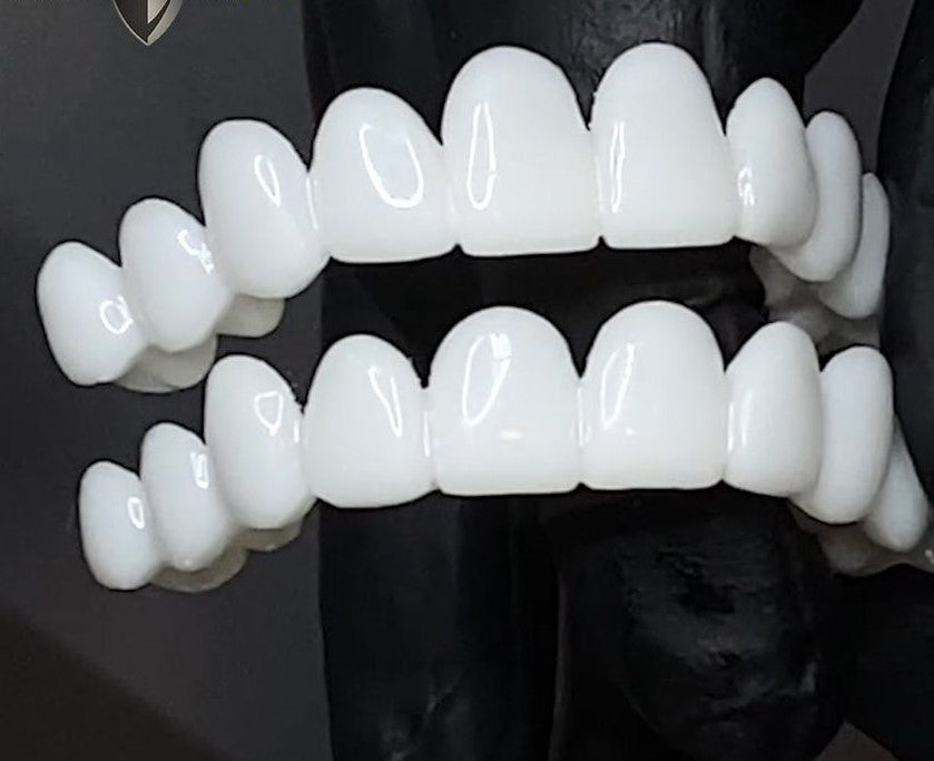 Faccette dentali estetiche professionali per un sorriso sicuro e splendido