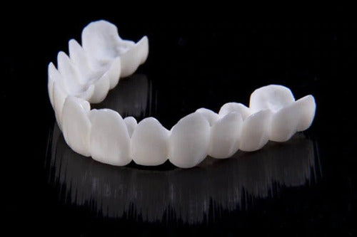Faccette dentali estetiche professionali per un sorriso sicuro e splendido