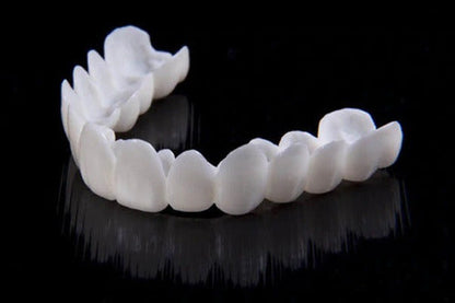 Faccette dentali estetiche professionali per un sorriso sicuro e splendido