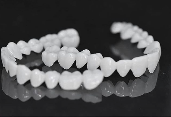 Faccette dentali estetiche professionali per un sorriso sicuro e splendido
