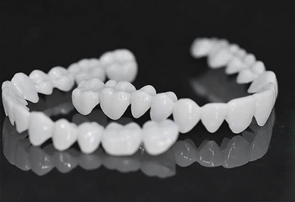 Faccette dentali estetiche professionali per un sorriso sicuro e splendido