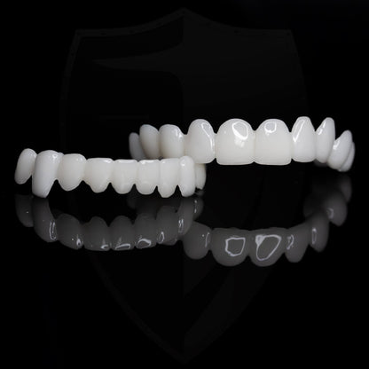 Faccette dentali estetiche professionali per un sorriso sicuro e splendido