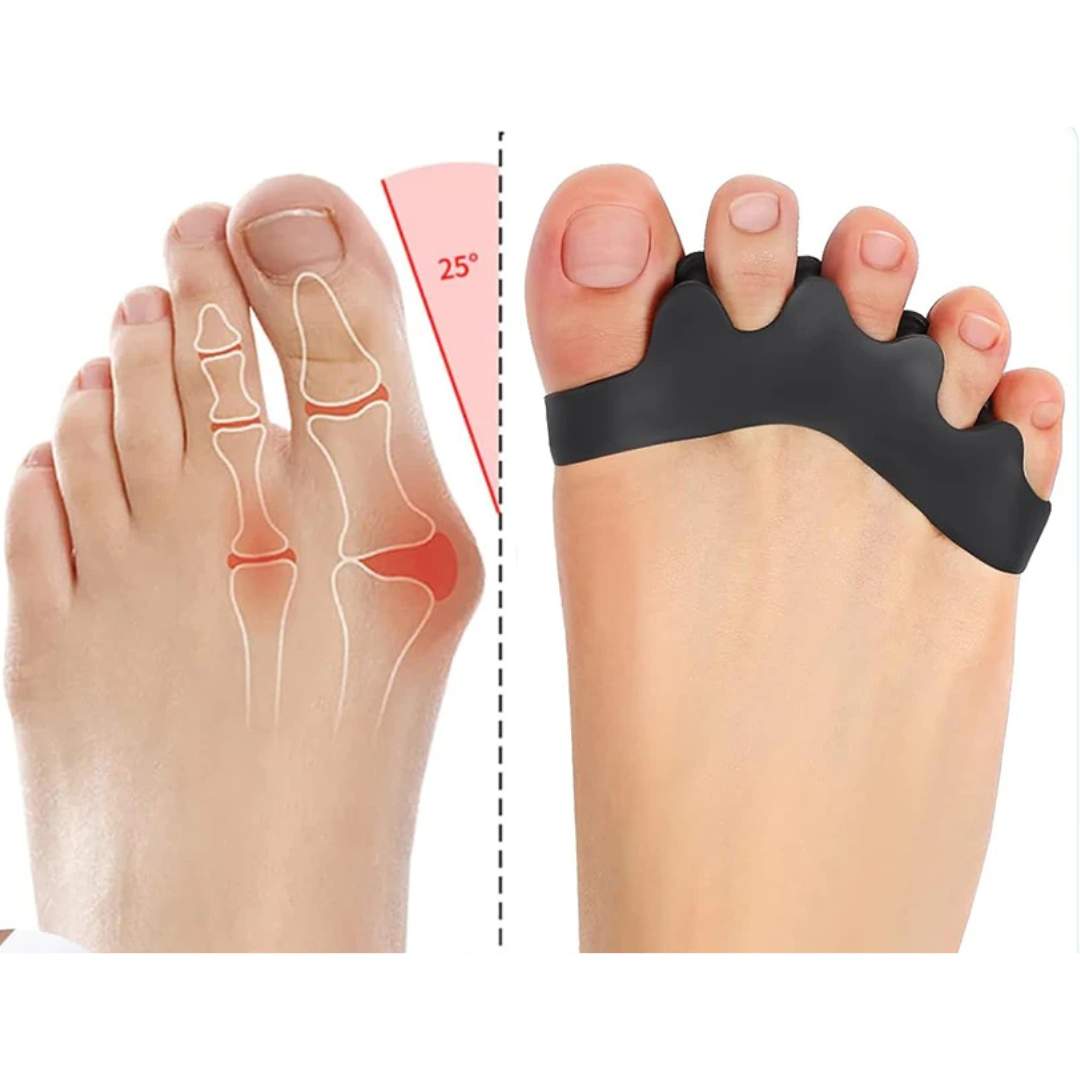 Separatore per dita dei piedi FlexAlign – Riallineamento e sollievo dal dolore per alluce valgo, dita sovrapposte e comf